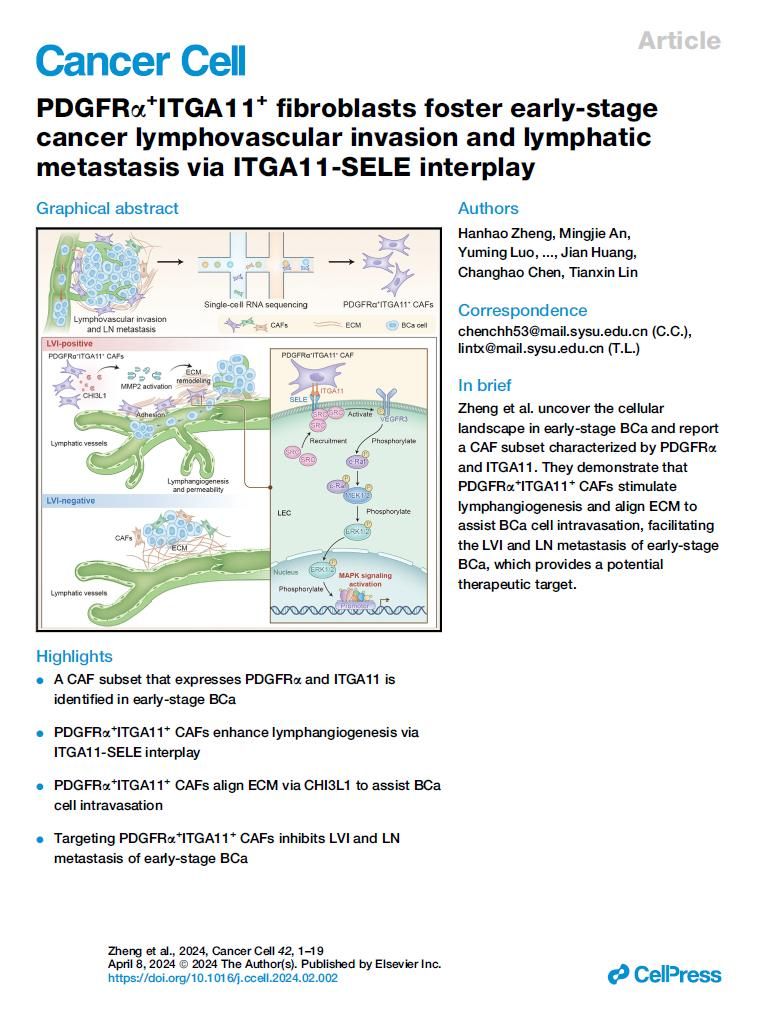 研究揭示早期膀胱癌脈管癌栓形成的關(guān)鍵分子機制
